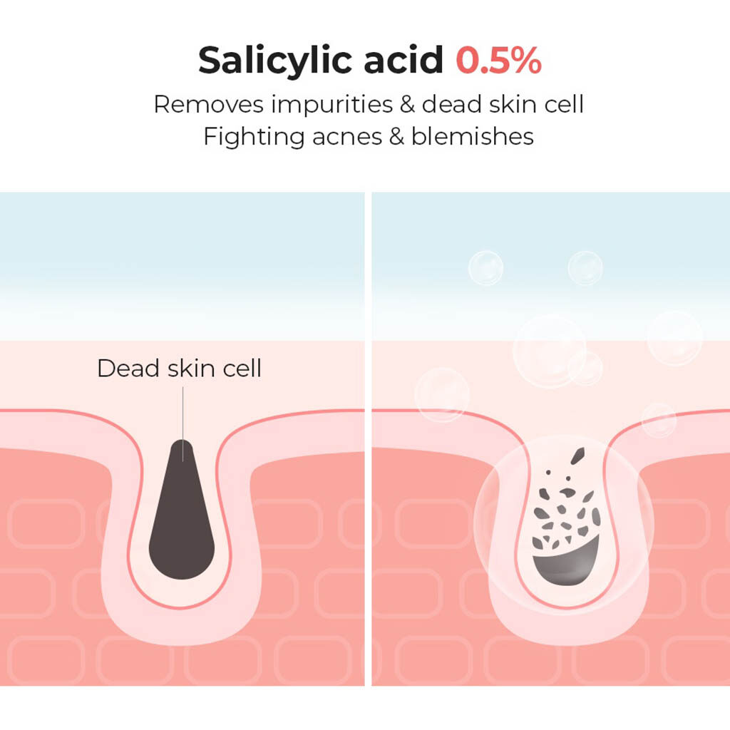 cosrx salicylic acid clears dirt
