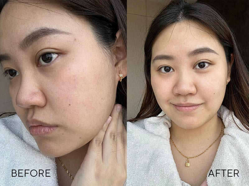 before-and-after-applying-the-led-light-mask
